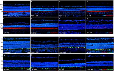 Early Events in Retinal Degeneration Caused by Rhodopsin Mutation or Pigment Epithelium Malfunction: Differences and Similarities